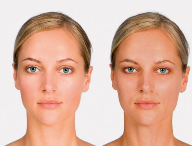 Face and before the rejuvenation