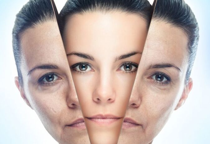 The process of eliminating age-related changes in the skin of the face